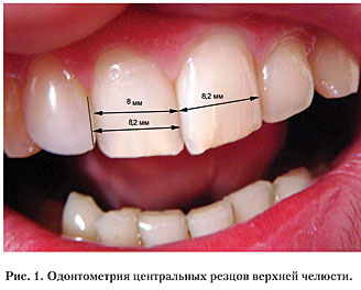 Методы исследования зубов - одонтометрия