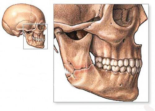 Строение челюсти