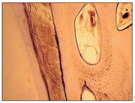 Электронная микрофотография. Волокна периодонта
