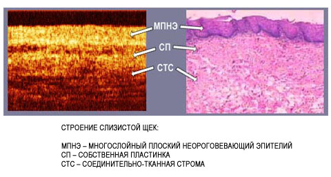 Особенности слизистой языка